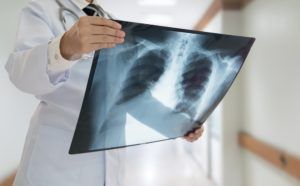 X-Rays in Urgent Care